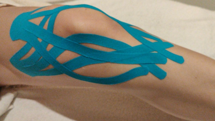 Kinesiotaping